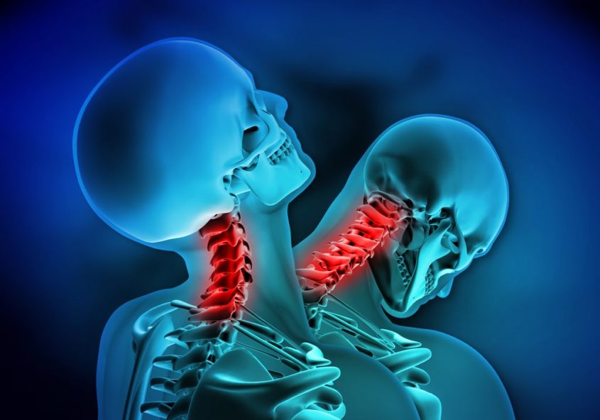 What Is Whiplash in a Car Accident in Brooklyn NY