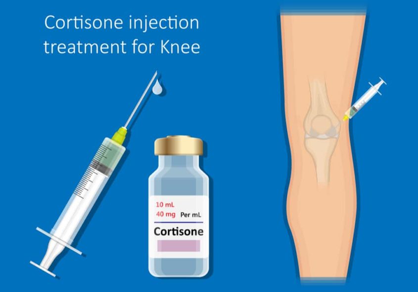 Dolor de Rodilla Inyecciones de Cortisona en Brooklyn, NY