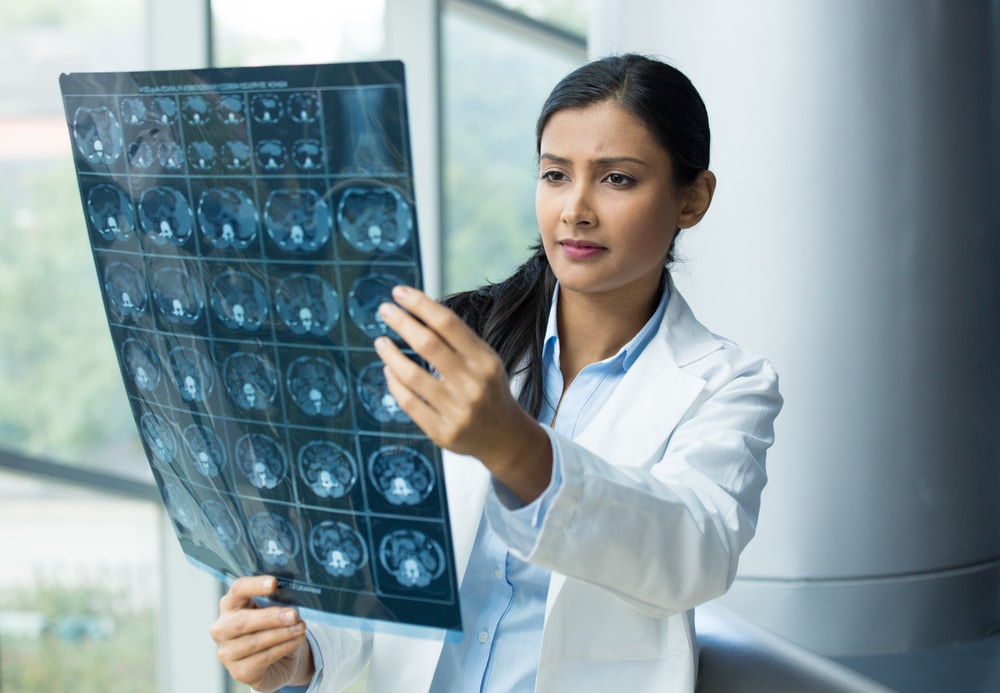 Cómo diagnostican sus lesiones los especialistas en neurología