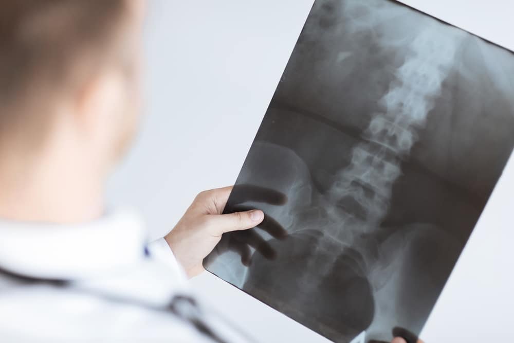 Diagnosing Spinal Cord Injuries